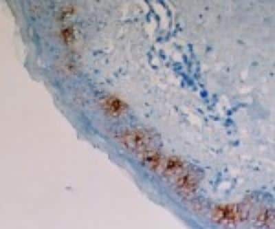 Immunohistochemistry-Frozen: Langerin/CD207 Antibody (929F3.01) [DDX0362P-100]