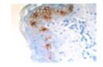 Immunohistochemistry-Frozen: Langerin/CD207 Antibody (929F3.01) [DDX0362P-100]