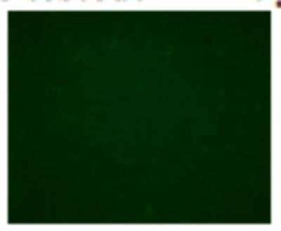 Immunohistochemistry: Langerin/CD207 Antibody (DCGM4/122D5) [DDX0363P-100]