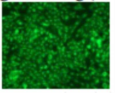Immunohistochemistry: Langerin/CD207 Antibody (DCGM4/122D5) [DDX0363P-100]