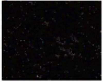 Immunohistochemistry: Langerin/CD207 Antibody (DCGM4/122D5) [DDX0363P-100]