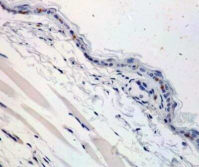 Immunohistochemistry-Paraffin: Langerin/CD207 Antibody [NB100-56733]