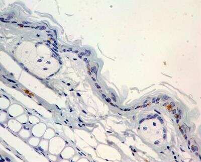 Immunohistochemistry-Paraffin: Langerin/CD207 Antibody [NB100-56733]