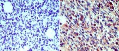 Immunohistochemistry-Paraffin: Langerin/CD207 Antibody [NB100-56733]