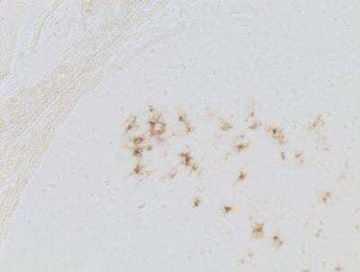Immunohistochemistry-Paraffin: Langerin/CD207 Antibody [NB100-56733]