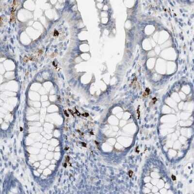 Immunohistochemistry-Paraffin: Langerin/CD207 Antibody [NBP1-84448]