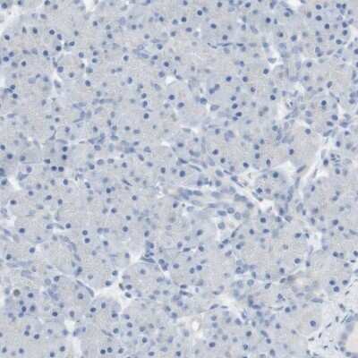 Immunohistochemistry-Paraffin: Langerin/CD207 Antibody [NBP1-84448]