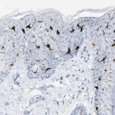 Immunohistochemistry-Paraffin: Langerin/CD207 Antibody [NBP1-84448]
