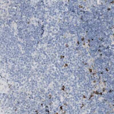 Immunohistochemistry-Paraffin: Langerin/CD207 Antibody [NBP1-84448]