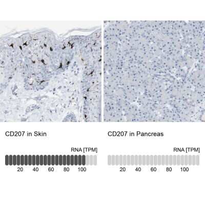 Immunohistochemistry-Paraffin: Langerin/CD207 Antibody [NBP1-84448]
