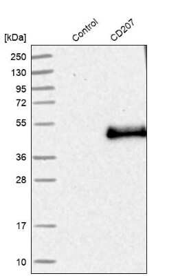 Western Blot: Langerin/CD207 Antibody [NBP1-84448]