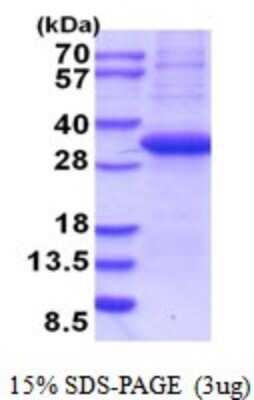 SDS-PAGE: Recombinant Human Langerin/CD207 His Protein [NBP2-52050]