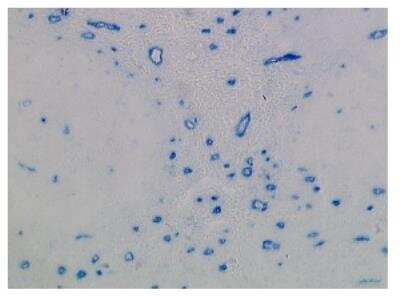 Immunohistochemistry: Langerin associated lectin Antibody (109B8.02) [DDX0350P-100]