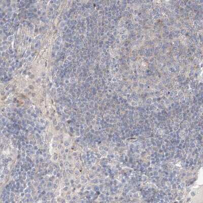 Immunohistochemistry-Paraffin: Lano Antibody [NBP1-88016]