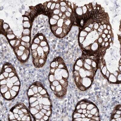 Immunohistochemistry-Paraffin: Lano Antibody [NBP1-88016]