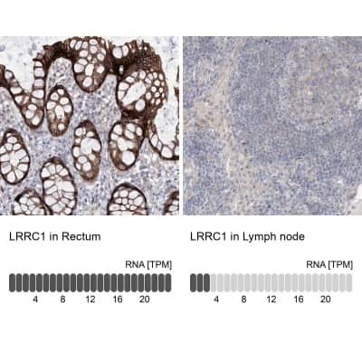 Immunohistochemistry-Paraffin: Lano Antibody [NBP1-88016]