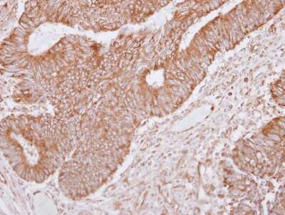 Immunohistochemistry-Paraffin: Lano Antibody [NBP2-19332]