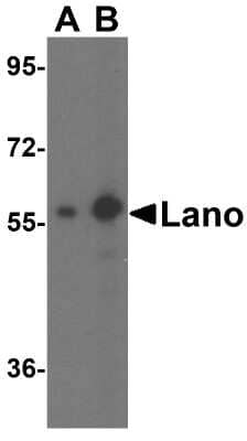 Western Blot: Lano AntibodyBSA Free [NBP1-76678]