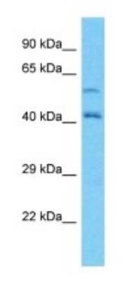 Western Blot: Lano Antibody [NBP3-09508]