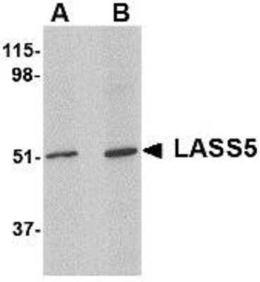 Western Blot: Lass5 AntibodyBSA Free [NBP1-76964]