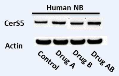 Western Blot: Lass5 AntibodyBSA Free [NBP1-76964]