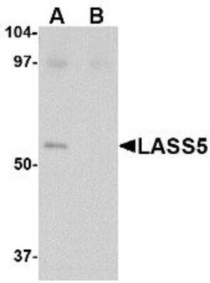 Western Blot: Lass5 AntibodyBSA Free [NBP1-77328]