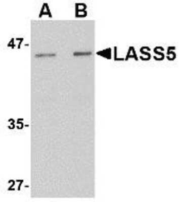 Western Blot: Lass5 AntibodyBSA Free [NBP1-77329]