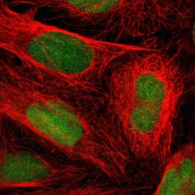 Immunocytochemistry/ Immunofluorescence: Latent TGF-beta bp2/LTBP-2 Antibody [NBP1-88411]