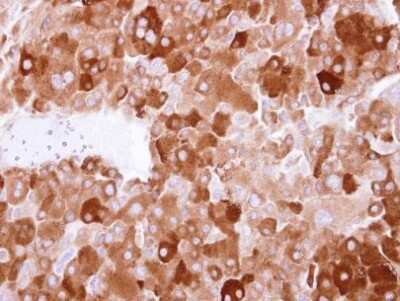 Immunohistochemistry-Paraffin: Latent TGF-beta bp4 Antibody [NBP2-43671]