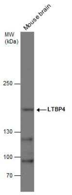 Western Blot: Latent TGF-beta bp4 Antibody [NBP2-43671]