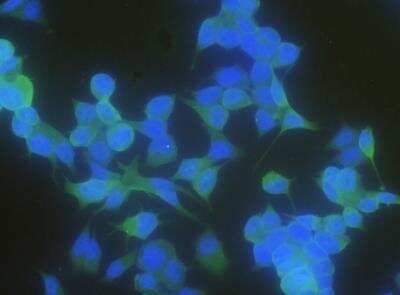 Immunocytochemistry/ Immunofluorescence: Latexin Antibody (101) [NBP2-89341]