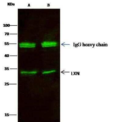 Immunoprecipitation: Latexin Antibody (101) [NBP2-89341]