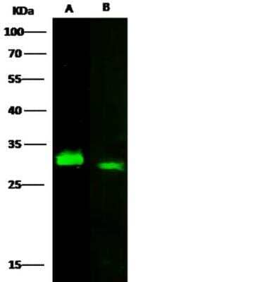 Western Blot: Latexin Antibody (101) [NBP2-89341]