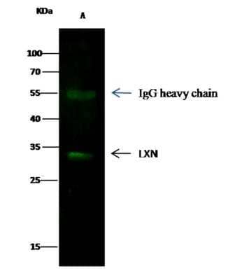 Immunoprecipitation: Latexin Antibody (8E1G6C1D4) [NBP3-06087]