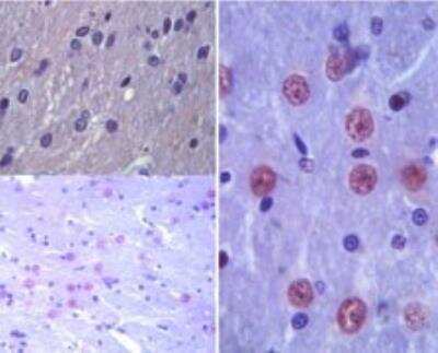 Immunohistochemistry-Paraffin: Latexin Antibody [NBP2-23723]