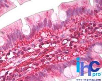 Immunohistochemistry-Paraffin: Latexin Antibody [NBP2-24530]