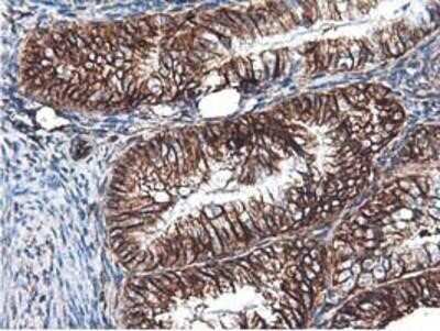 Immunohistochemistry-Paraffin: Latexin Antibody (OTI1E10) [NBP2-01382]