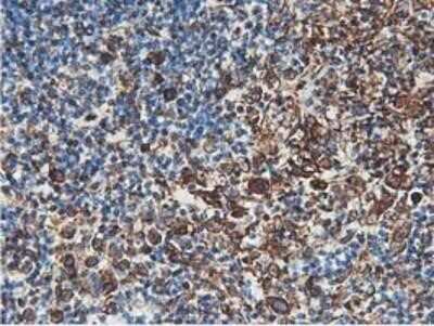 Immunohistochemistry-Paraffin: Latexin Antibody (OTI1E10) [NBP2-01382]