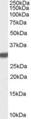 Western Blot: Latexin Antibody [NB100-57856]