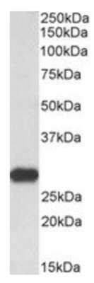 Western Blot: Latexin Antibody [NB100-57856]