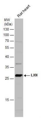 Western Blot: Latexin Antibody [NBP1-32525]