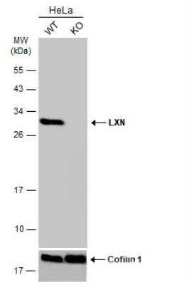 Western Blot: Latexin Antibody [NBP1-32525]