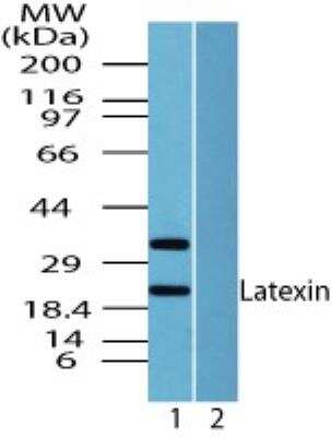 Western Blot: Latexin Antibody [NBP2-24530]