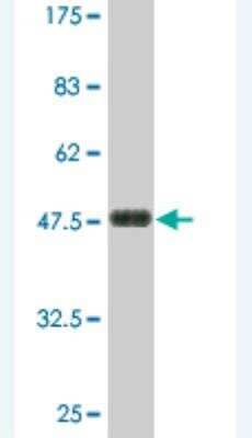 Western Blot: Latrophilin 1/LPHN1 Antibody (4E12) [H00022859-M03]