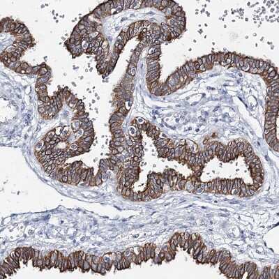 Immunohistochemistry-Paraffin: Latrophilin 1/LPHN1 Antibody [NBP1-85609]