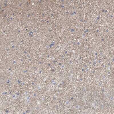 Immunohistochemistry-Paraffin: Latrophilin 1/LPHN1 Antibody [NBP1-85609]