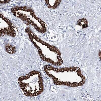 Immunohistochemistry-Paraffin: Latrophilin 1/LPHN1 Antibody [NBP1-85609]