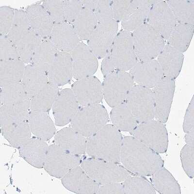 Immunohistochemistry-Paraffin: Latrophilin 1/LPHN1 Antibody [NBP1-85609]