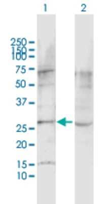 Western Blot: Latrophilin 1/LPHN1 Antibody [H00022859-D01P]