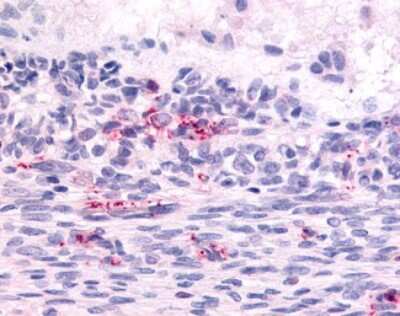 Immunohistochemistry-Paraffin: Latrophilin 2/LPHN2 Antibody - BSA Free [NLS1133]